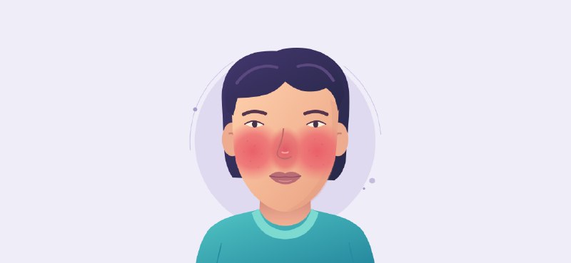 你的脸红是什么红：了解玫瑰痤疮 - 少数派