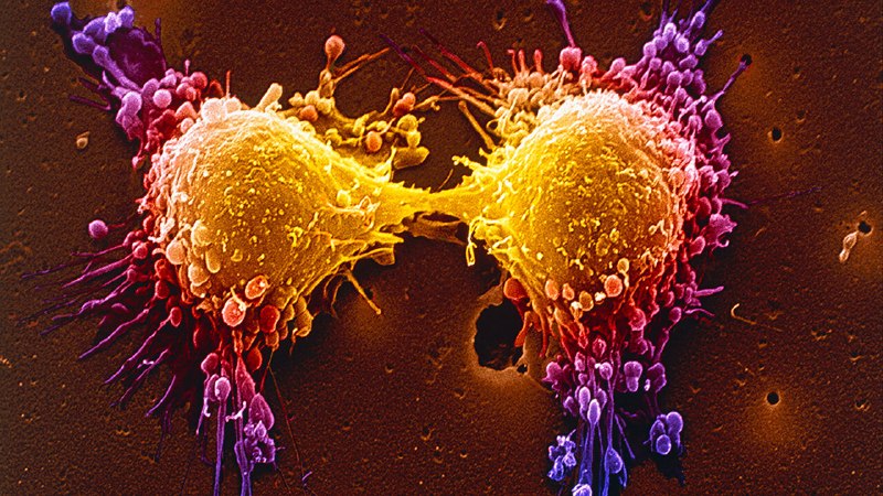 Tumour cells use a genetic trick to become drug-resistant