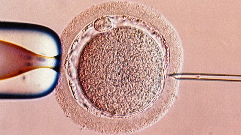 Do high-tech “add-ons” increase the chance that IVF will work?